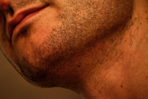 Depilación definitiva de la barba debido a la irritación